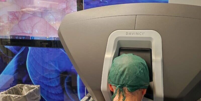 San Pio, asportazione robot-assistita di un tumore ovarico benigno